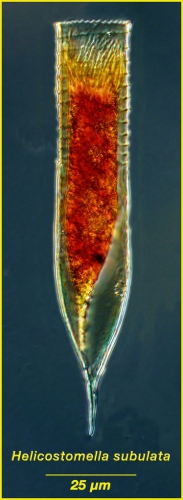 Helicostomella subulata (Ehrenberg, 1833) Jörgensen, 1924  