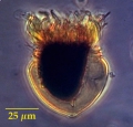 Metacylis jörgensenii (Cleve) Kofoid et Campbell, 1929  