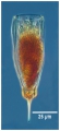 Parundella inflata Kofoid & Campbell, 1929  AphiaID: 417256 