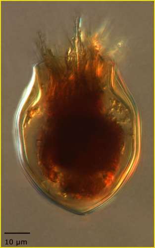 Proplectella ellipsoida Kofoid & Campbell, 1929  