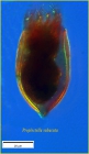 Proplectella subacuta Kofoid & Campbell, 1929 