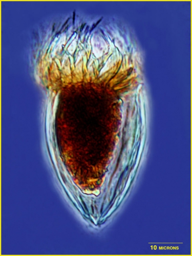 Protorhabdonella curta Cleve, 1901  