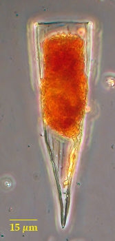 Protorhabdonella striatura Kofoid & Campbell, 1929   