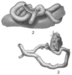 Chromista - Foraminifera (foraminifers)