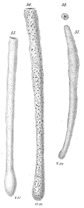 Hyperammina elongata Hyperammina elongata