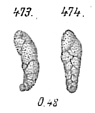 Virgulina subsquamosa Virgulina subsquamosa
