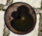 Protozoans