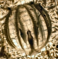 Ctenophora (sea gooseberries)