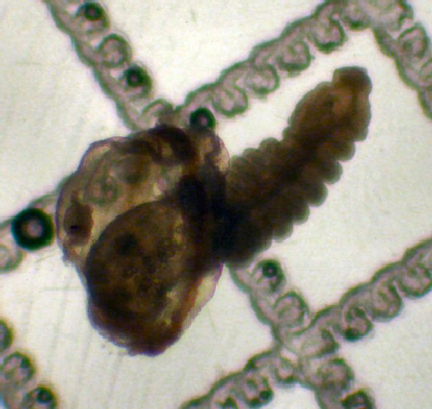 Polygordius Polygordius