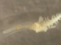 Chaetognatha (arrow worms)