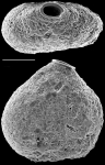 Chromista - Foraminifera (foraminifers)