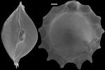 Chromista - Foraminifera (foraminifers)