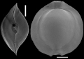 Chromista - Foraminifera (foraminifers)