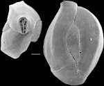 Chromista - Foraminifera (foraminifers)