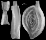 Chromista - Foraminifera (foraminifers)