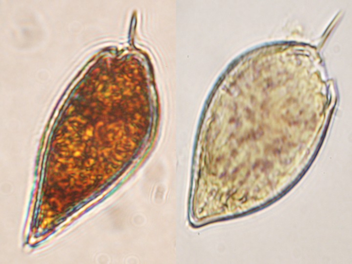 Prorocentrum micans Prorocentrum micans