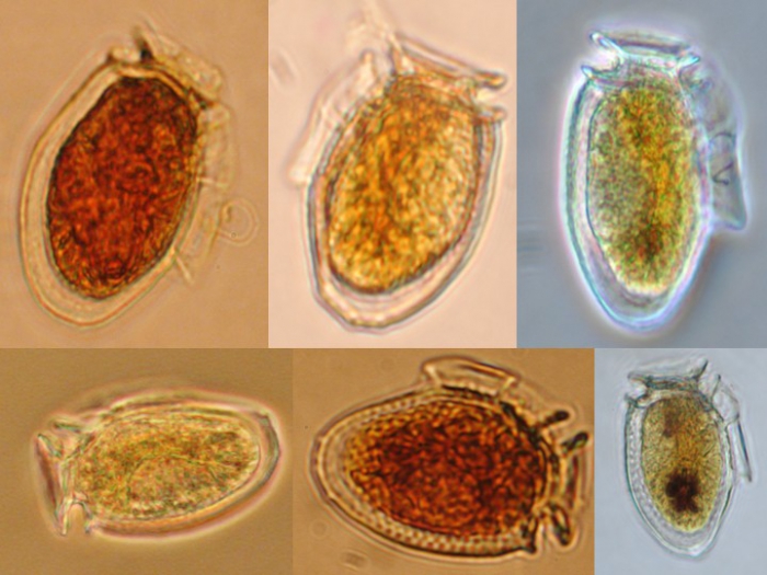 Dinophysis acuminata Dinophysis acuminata