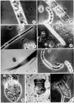 Plate I - Light Micrograph (LM)