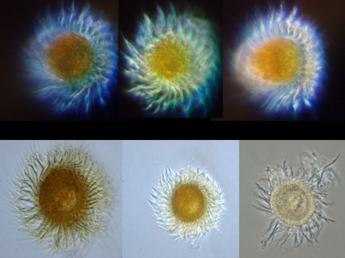 Planktonic Ciliates