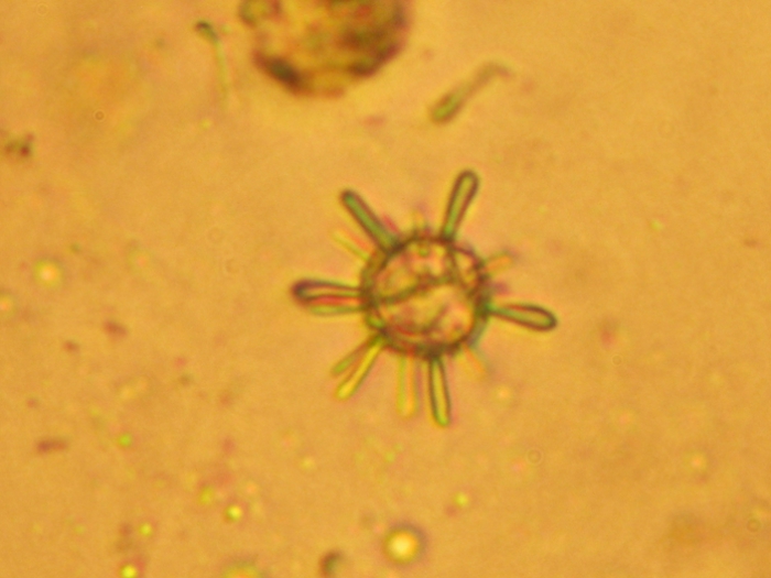 Rhabdosphaera claviger Rhabdosphaera claviger