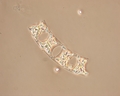 Chromista - Bacillariophyceae (diatoms)