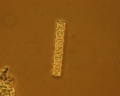 Chromista - Bacillariophyceae (diatoms)