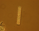 Diatoms