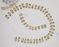 Chromista - Bacillariophyceae (diatoms)