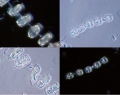 Chromista - Bacillariophyceae (diatoms)