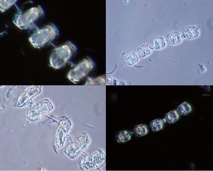 Thalassiosira Thalassiosira