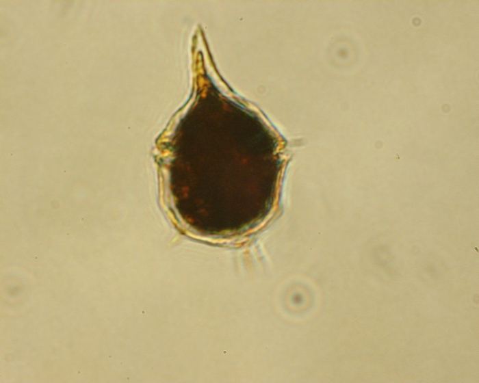 Amylax tricantha Amylax tricantha