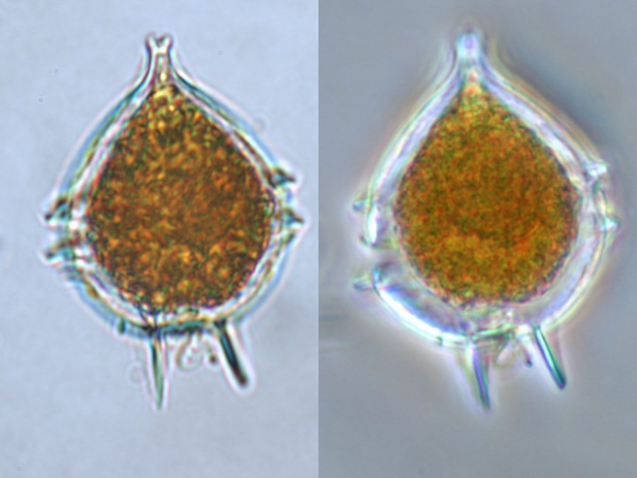 Protoperidinium steinii Protoperidinium steinii