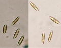 Chromista - Bacillariophyceae (diatoms)