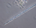 Chromista - Bacillariophyceae (diatoms)