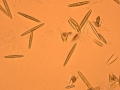 Chromista - Bacillariophyceae (diatoms)