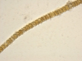 Chromista - Bacillariophyceae (diatoms)