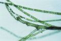 Chlorophyta (green algae)