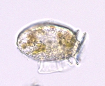Dinophysis acuminata Dinophysis acuminata