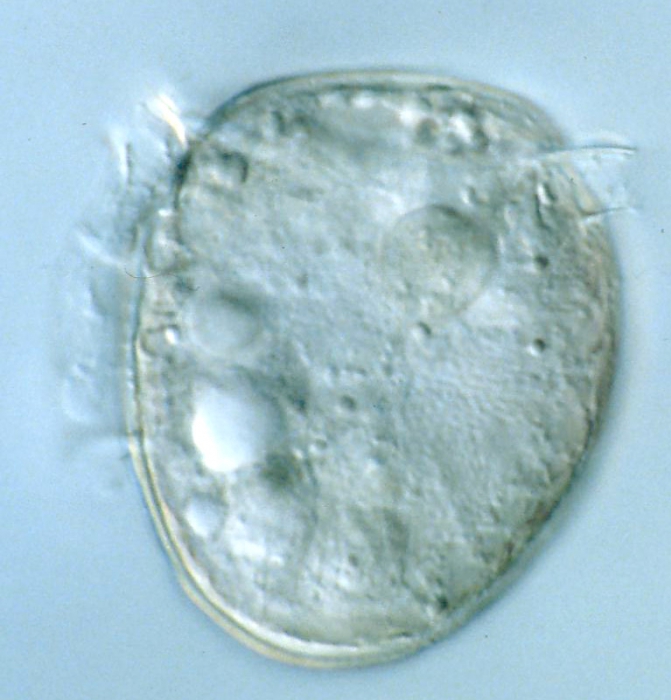 Dinophysis rotundata