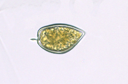 Prorocentrum micans Prorocentrum micans