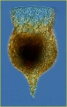 Codonella amphorella Biederman,1893