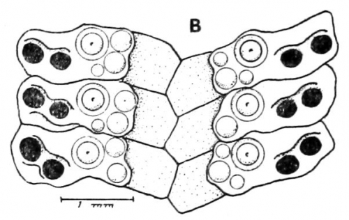 Goniocidaris (Aspidocidaris) parasol