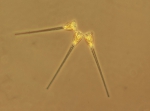Asterionellopsis glacialis