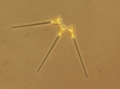 Chromista - Bacillariophyceae (diatoms)