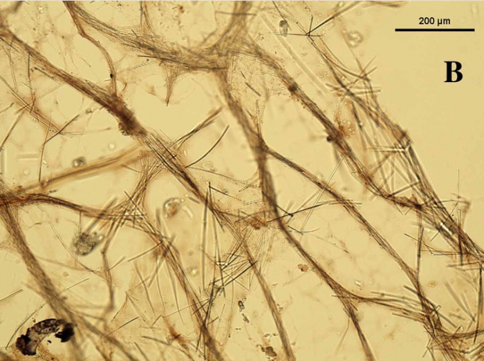 Ulosa pacifica skeleton