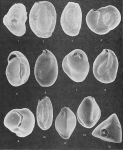 Foraminifera - Plate 11 - Miliolidae