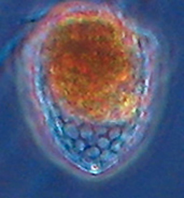 Acanthostomella minutisma Acanthostomella minutisma