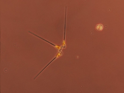 Asterionellopsis glacialis