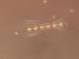 Chaetoceros laciniosus