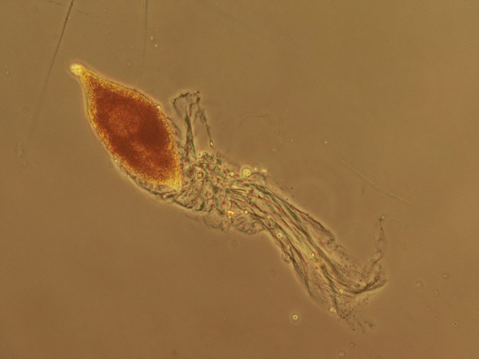 Gyrodinium Gyrodinium